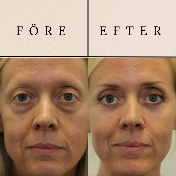 Revive - Light Eye Massage Cream