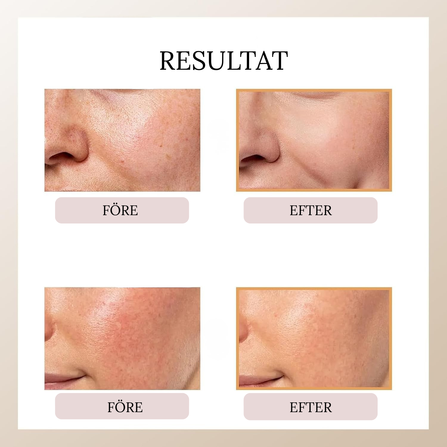 PEEL SHOT GLOW RICE AMPOULE DUO